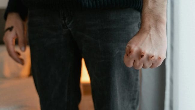 Bloody Knuckles